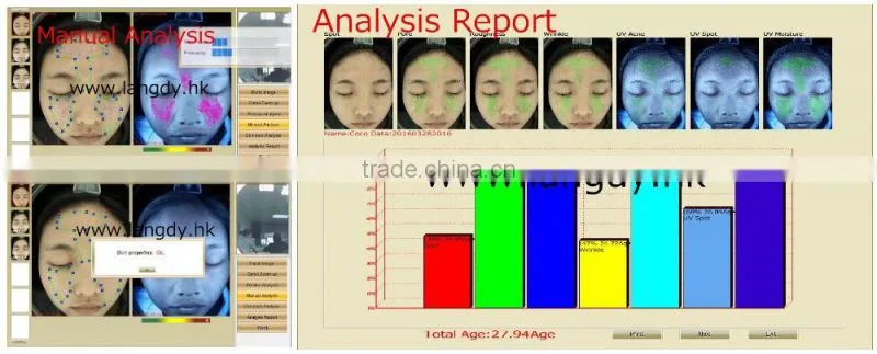 computer software skin analysis system acne wrinkle spot pore analyzer device