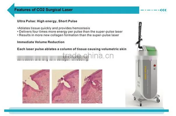 Big discount for High power RF tube CO2 fractional laser vaginal tightening skin resurfacing beauty machine--CV-I