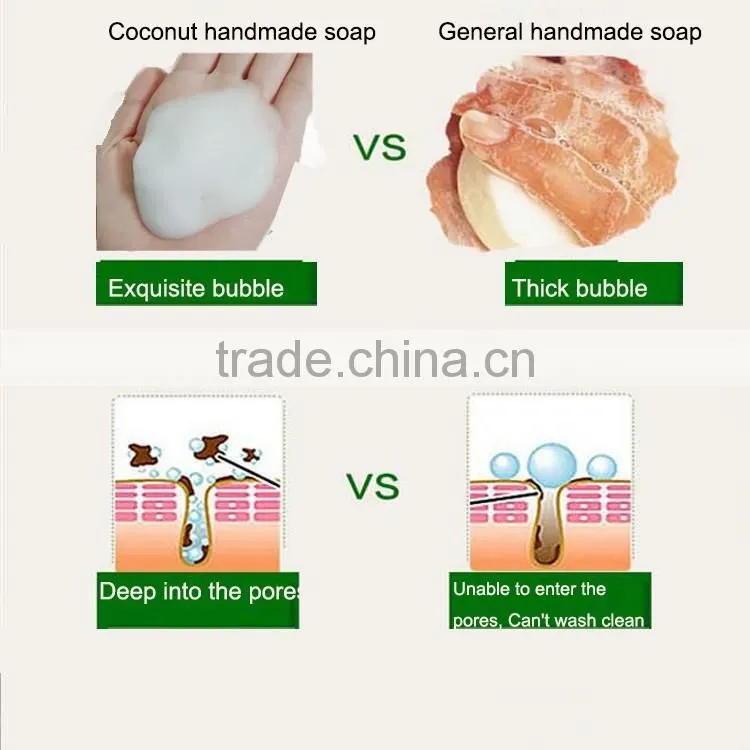 Best Skin Whitening soap handmade soap