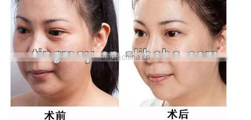 facial exercise machines for home use tm-270