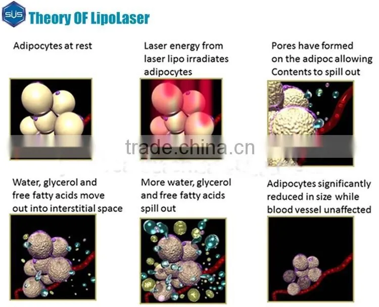 Home use lipolaser slimming best lipo laser machine