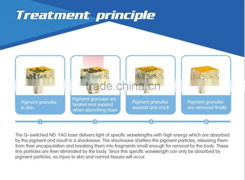 Stationary Clinic Use Q Switched Korean Tri Beam Tattoo Laser Nd Yag Laser