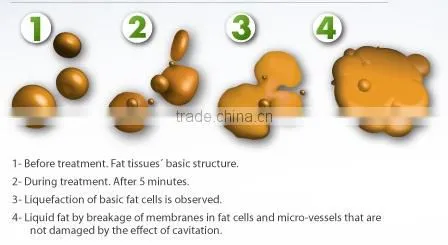 Professional 2014 Quick fat burn Ce approval hot selling EXW lowest home use cav+rf machine