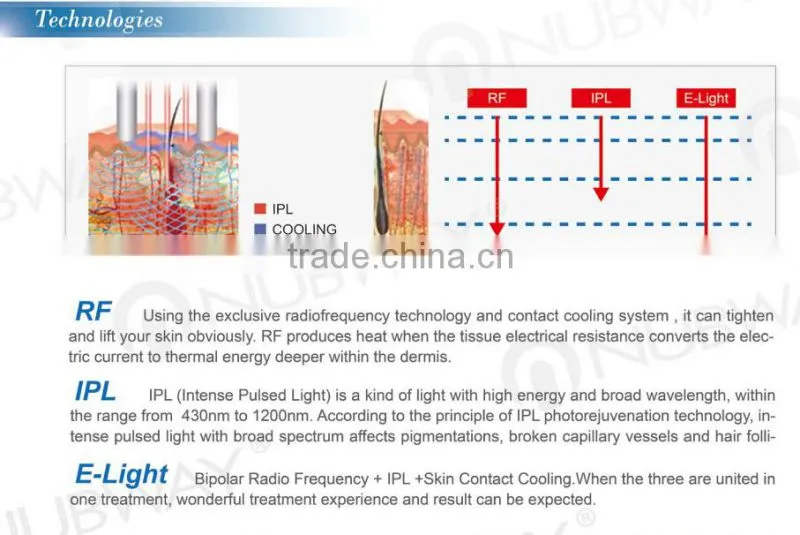 ICE SHR SSR Hair Removal Skin Rejuvenation Pigmentation&Vascular&Acne&Spot Removal Beauty Salon Equipment&Machine