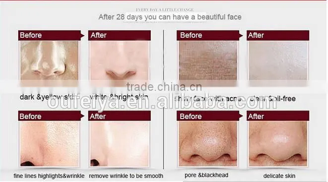 portable high frequency facial machines