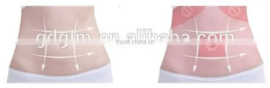 Good quality ultrasound hifu equipment manufacturer want distrobutor