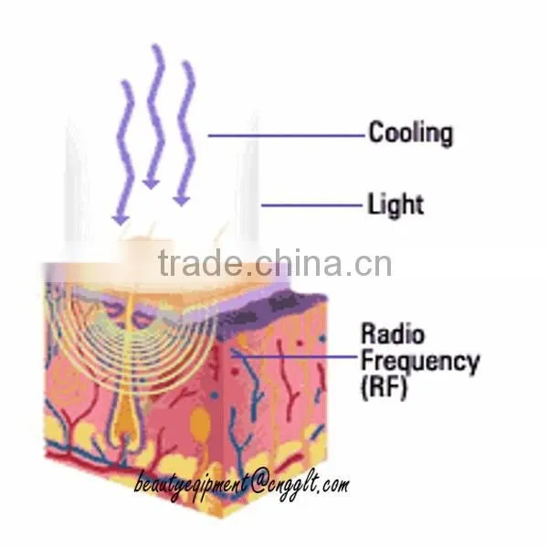 Hith quality CE approved skin tightning rf face lift machine