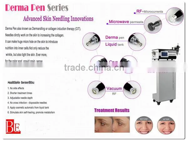 acne treatment face lift wrinkle machine
