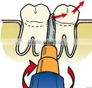 dental extraction elevators, dental elevators periosteal elevator