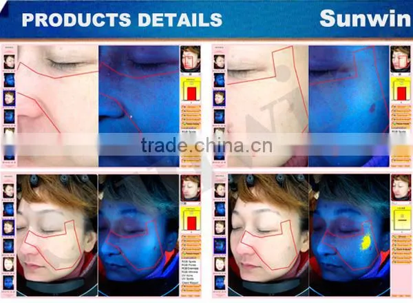 (On Promotion) Professional skin analyzer 3D magic mirror
