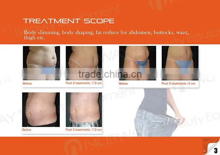 2015 leading body slimming spa use equipment HIFU ultrasound fat loss slimming device