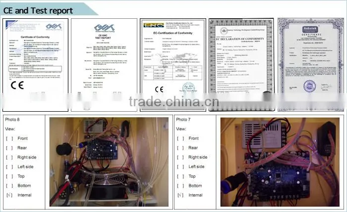 2015 Professional YAG laser tattoo removal machine