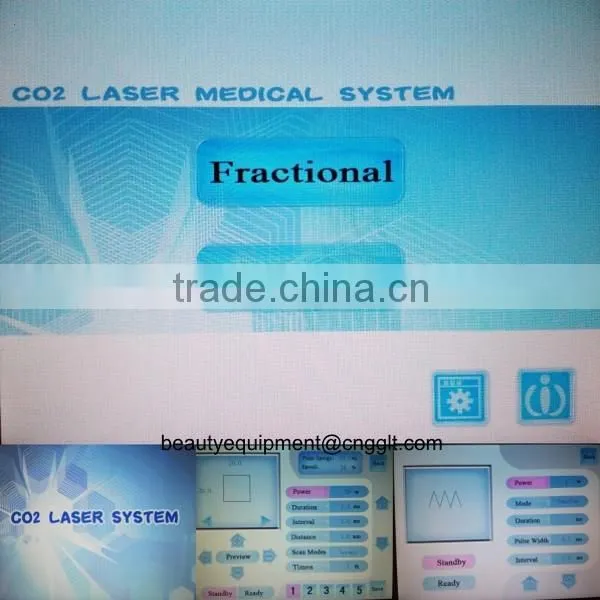 High qaulity glass co2 laser skin tag removal machine