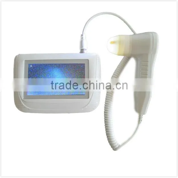 Bestseller 2014 skin analyzer korea
