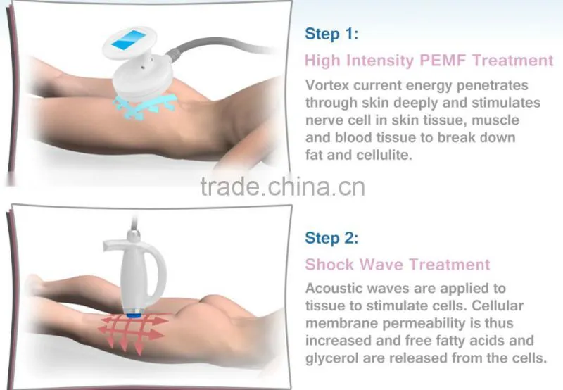 Acoustic Wave Therapy Pulsed Electro Magnetic Field PEMF Therapy
