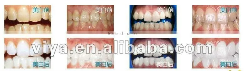VY-EL003 Hot sale teeth whitening machine salon teeth whitening kit