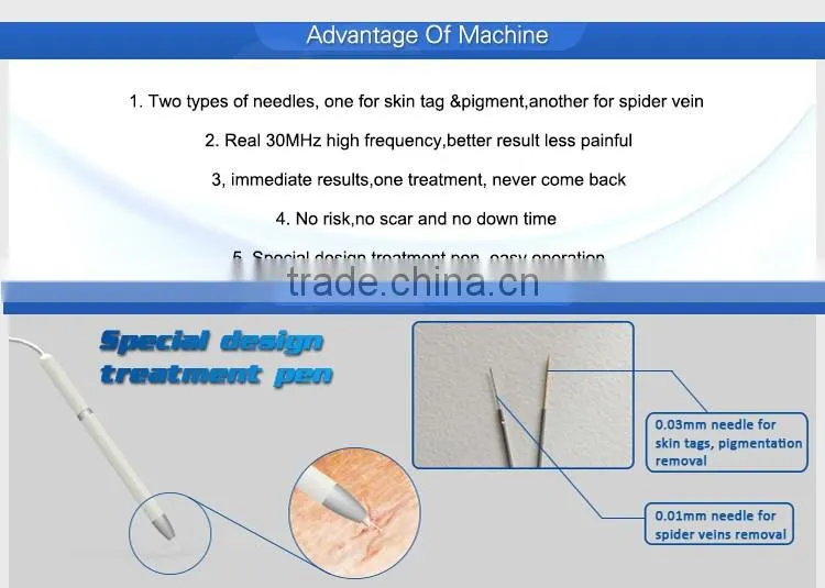 30MHz RBS beauty machine coagulation vessels laser blood vessel removal device