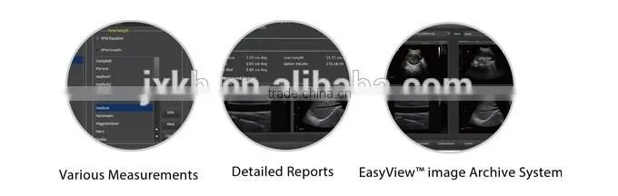2016 NEW ultrasound scanner Color doppler