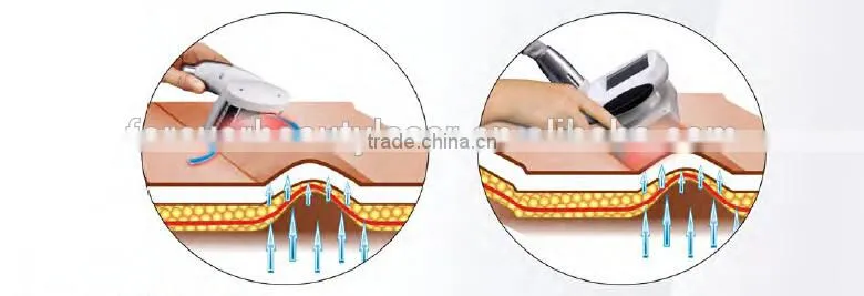 Two Vacuum Rollers+Six-polar RF+Infrared Laser+Valeshape Beauty Machine
