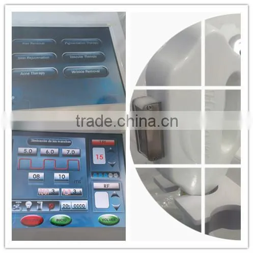 Best selling !!! ipl +rfl skin pigmentation treatment machine