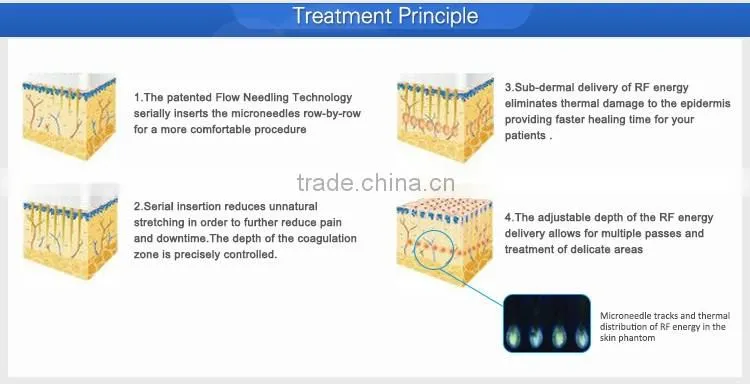 2 professional treatment handles rf fractional electric stretch mark micro needle