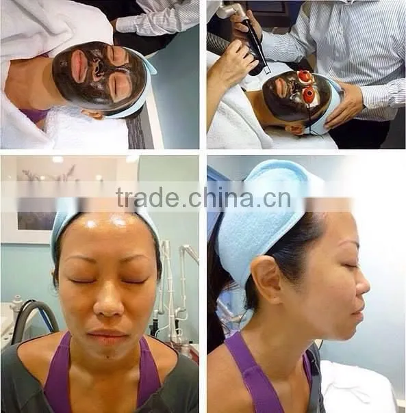 laser tattoo removal/q-switched laser price pigment tattoo removal/q switched nd yag eyebrow removal