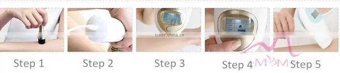 Mini Home Use Diode Laser 808 nm Hair Removal Machine For Face And Body