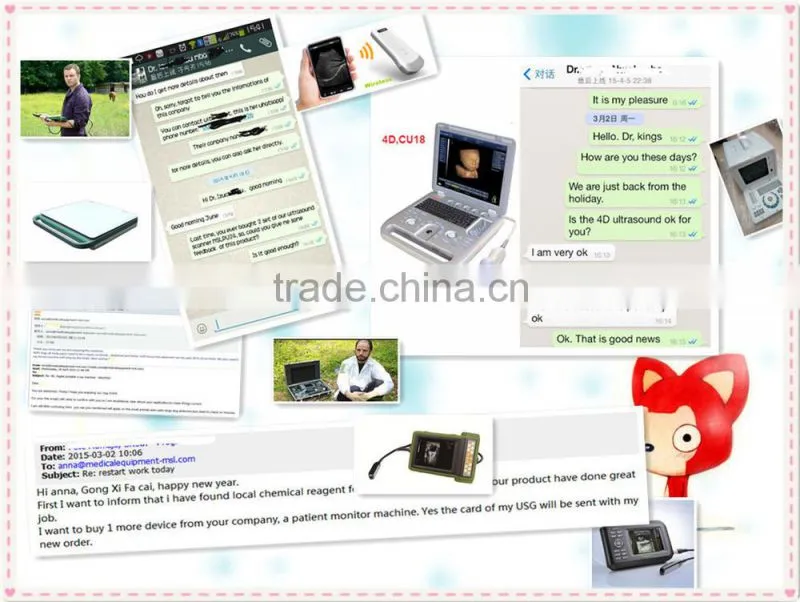 MSLPU25A HOT SALES Digital best Medical portable china portable ultrasound machine price