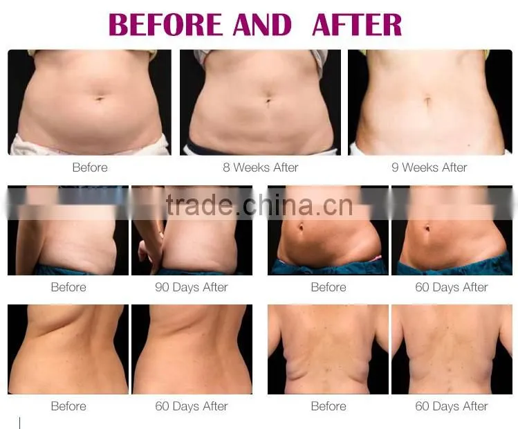 ultra slimming rf slimming beauty slimming body weight loss machine