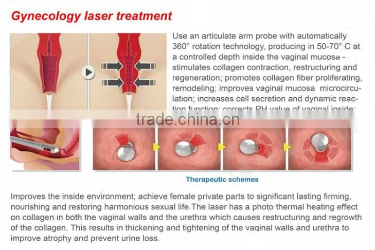 professional skin resurfacing co2 laser