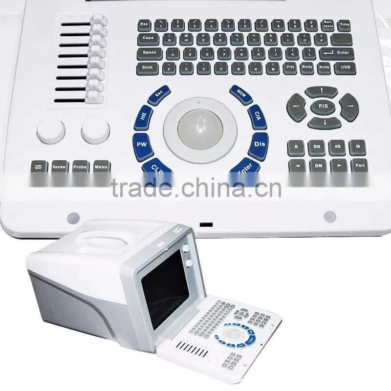 CE ISO approved 10-inch SVGA high resolution Full Digital Portable Ultrasound machine