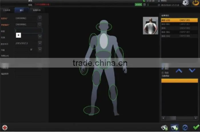 good selling cheapest price 14*17 inch FPD digital x ray flat panel detector