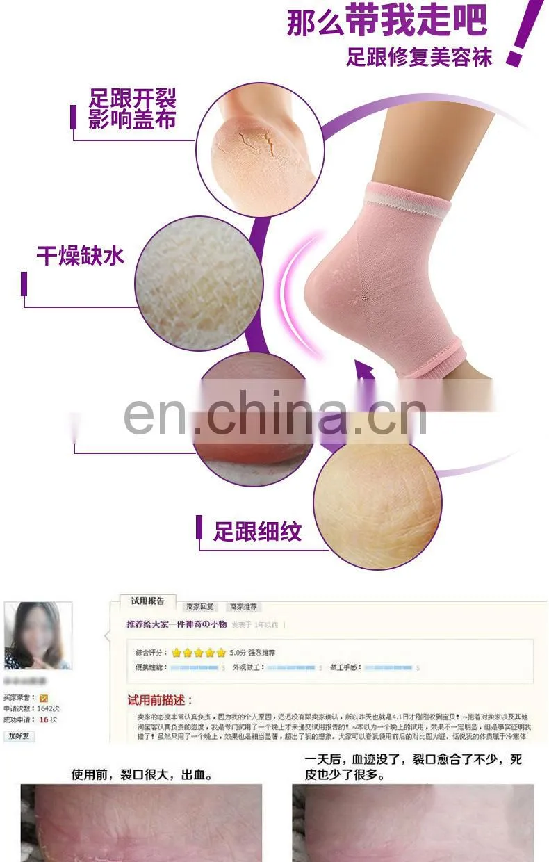 Moisturizing Cracked Heel Socks - Treat Dry Heels Fast Pain Relief from Cracking Feet with these Gel Heel Protector Pads