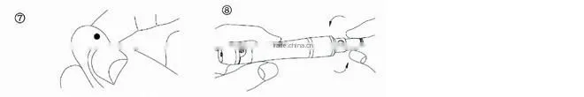 Safety Lancing Device with 6 lancets