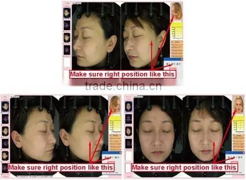 Skin Analyzer Type Portable Digital Skin analyzer