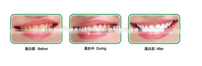 Factory Direct Wholesale Price Blue LED Lights Teeth Whitening Machine for Whitening Teeth