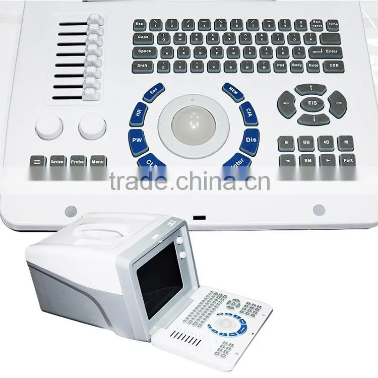 Medical hospital ultrasound diagnostic machine portable ultrasound equipment