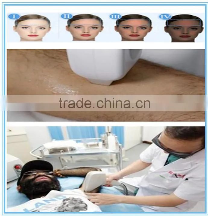 Permanent diode lazer hair removal machine