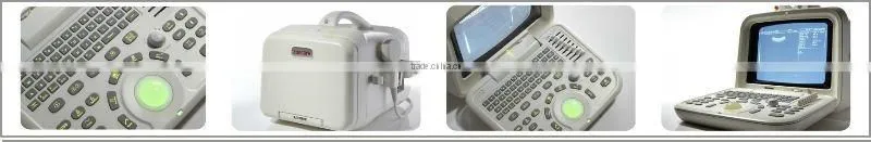 pc ultrasound scanner/usb ultrasound scanner