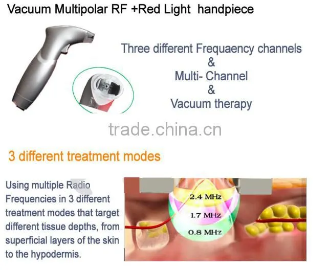 Slimming Machine in Laser Beauty Equipment Vacuum Multipolar RF Green/Red Light