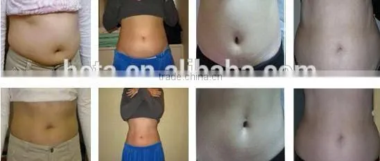 H-9008B 650 lipo diode laser slimming with 12 pads 76 lamps for fat burning easy operate laser machine