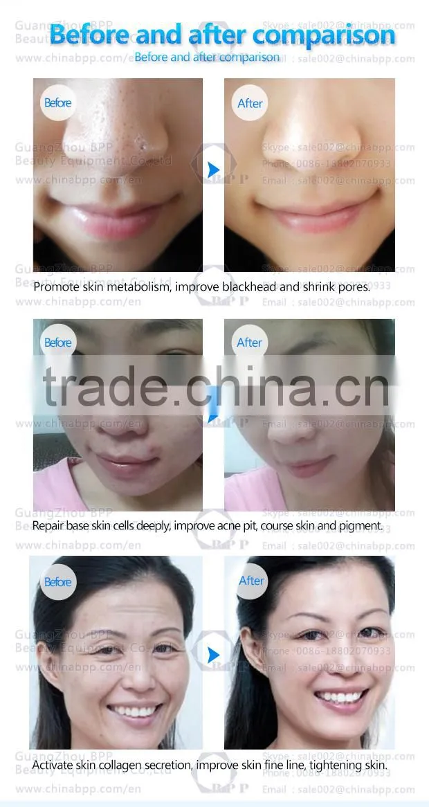 Factory wholesale home use skin rejuvenation led face mask