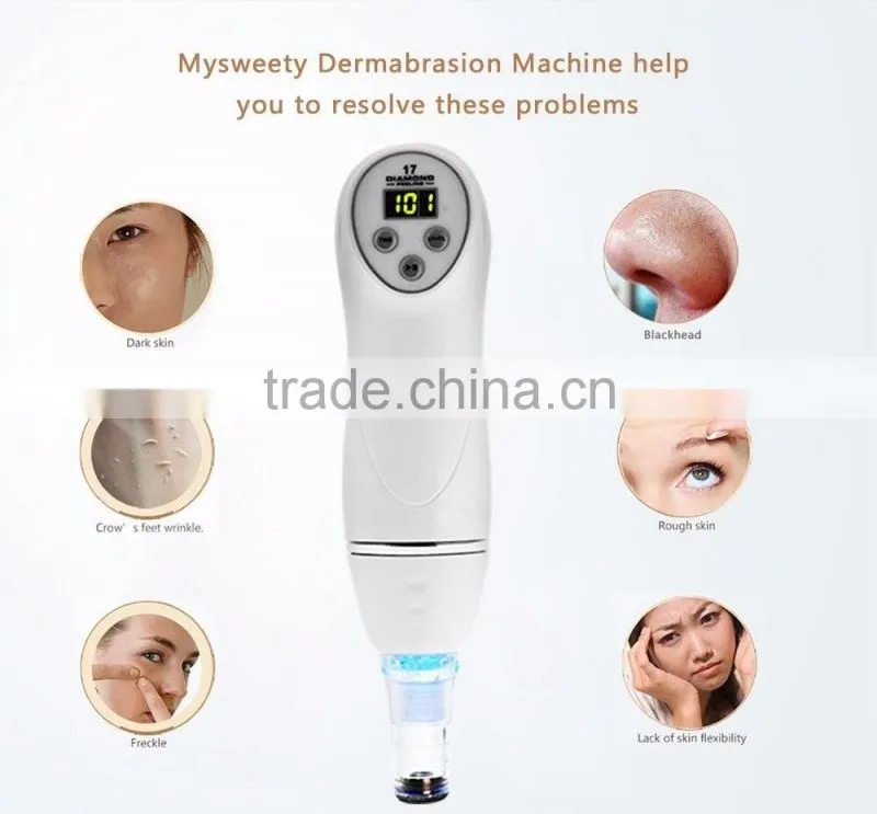 2016 Facial Pore Clean Acne Nose Blackheads Remover Microdermabrasion Rechargeable