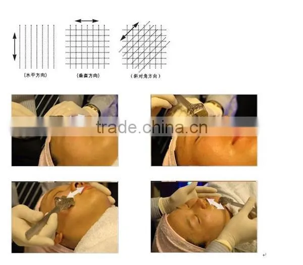 Titanium 192 Needles. Wrinkles, Acne, Derma Roller To Improve Skin Elasticity
