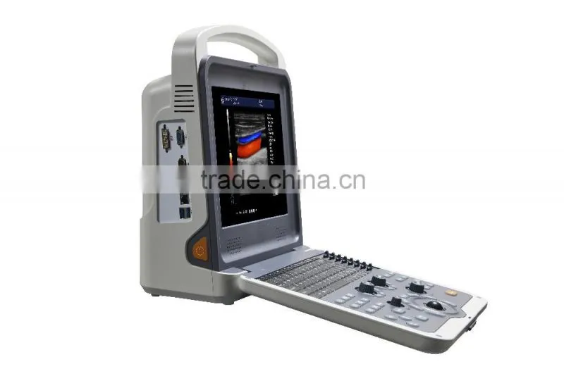 Digital Color Doppler 4D Ultrasound Machine K6