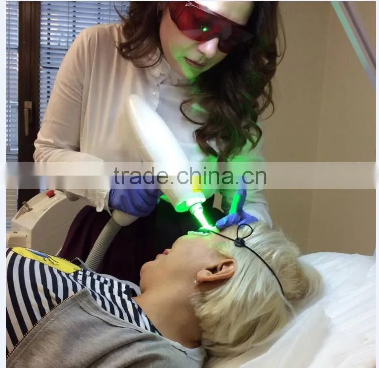 ND YAG Q-Switch laser best tattoo ND yag laser tattoo removal 1064nm and 532nm laser nd yag laser/ medical