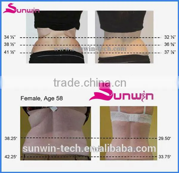 Best Cellulite fat removal machine with multi languages system
