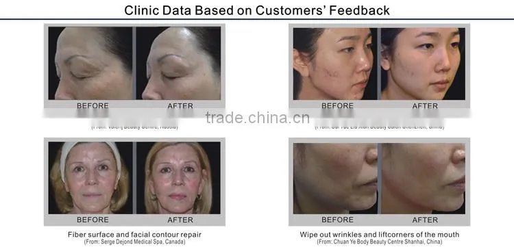 Good quality electro body slimming beauty equipment for home use