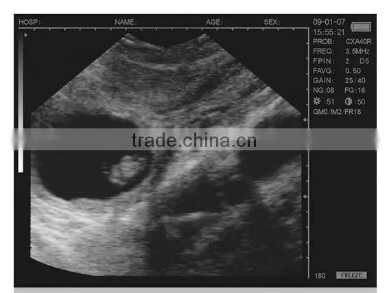 Cheap mobile vet ultrasound machine price M50