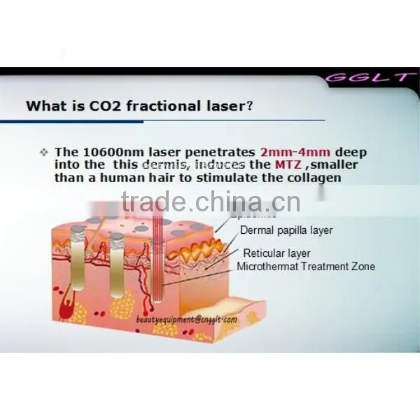 Portable CO2 Fractional Laser nd yag long pulse